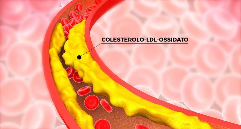 Fig.14: È il Colesterolo-LDL-Ossidato che contribuisce a formare la placca ateromasica all’interno del vaso e non il Colesterolo stesso.