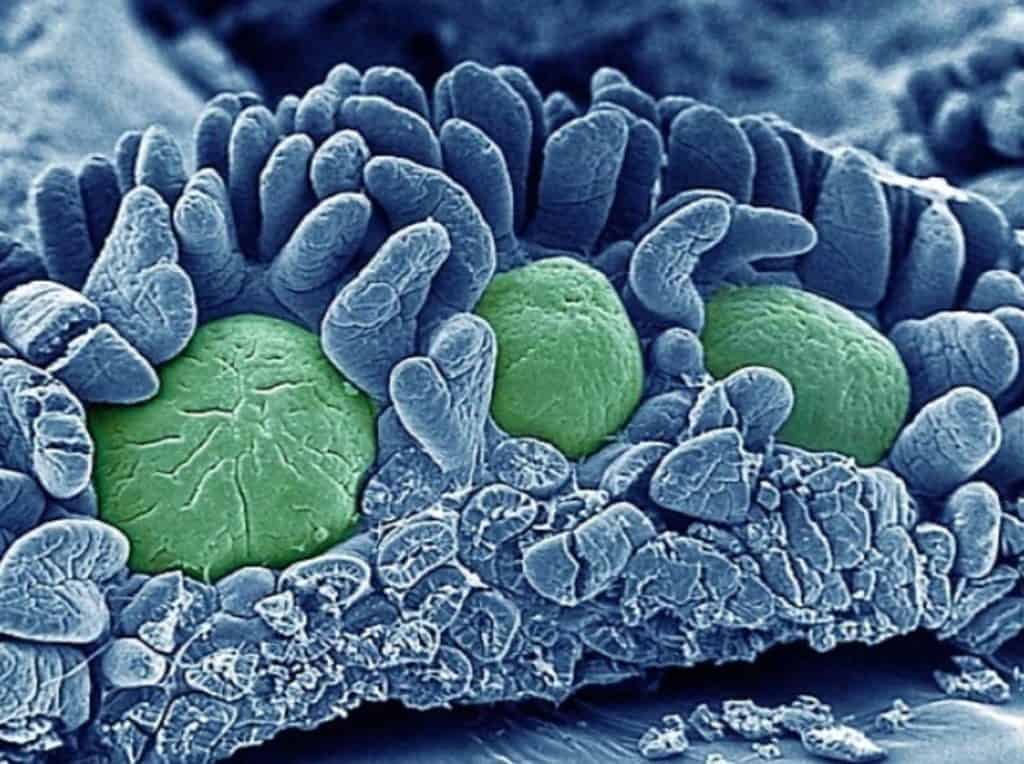 Fig.3: Le Placche di Peyer (in verde) - centraline immunologiche situate nella sotto-mucosa, tra le villosità dell’intestino tenue.